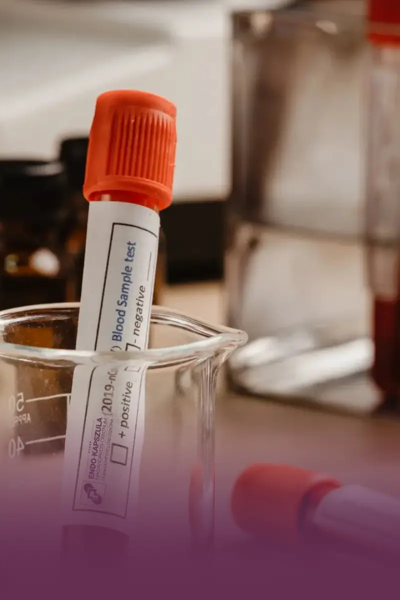 Vérminták a laboratóriumban